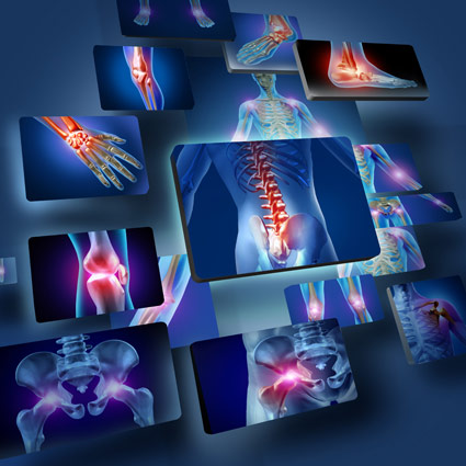 X-ray images of skeleton with multiple joints highlighted.