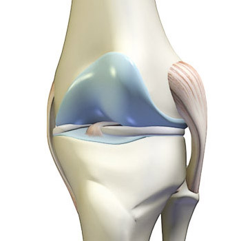 Image of a knee joint.