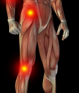 Image of musculoskeleton with joints highlighted.